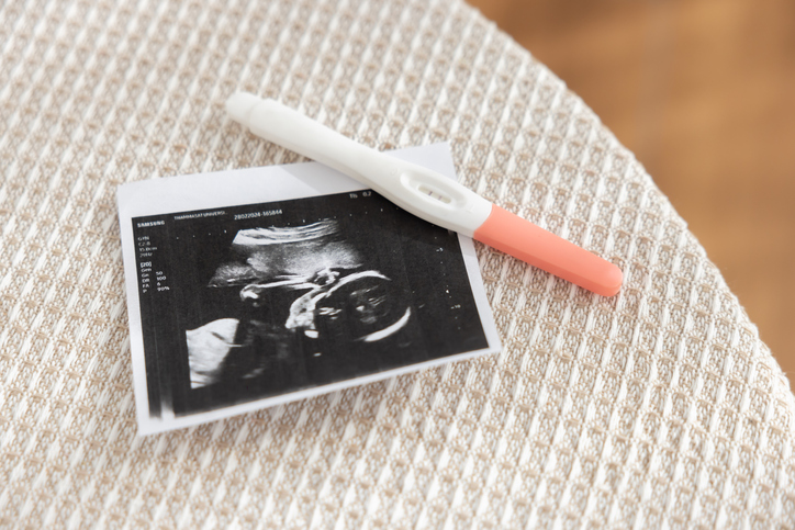 A positive pregnancy test alongside an ultrasound image on the table